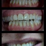 sonrisa dental cordillera