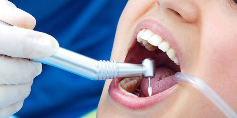 Urgencias dentales prótesis dientes Ortodoncia Invisible Implantes Dentales