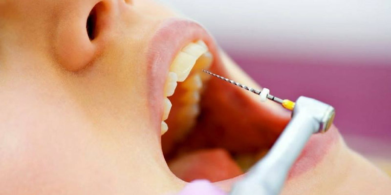 Tratamiento caries Extracciones Blanqueamiento dental Cirugia bucal