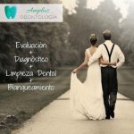 blanqueamiento dental en santiago