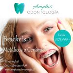 brackets en santiago