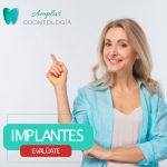 implantes dentales