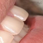 periodoncia en santiago